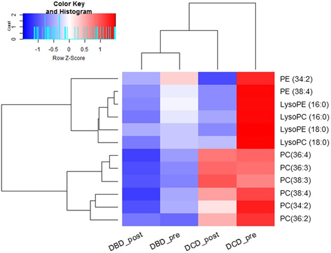 Lipidomics Comparing Dcd And Dbd Liver Allografts Uncovers Lysophospholipids Elevated In Recipients Undergoing Early Allograft Dysfunction Scientific Reports