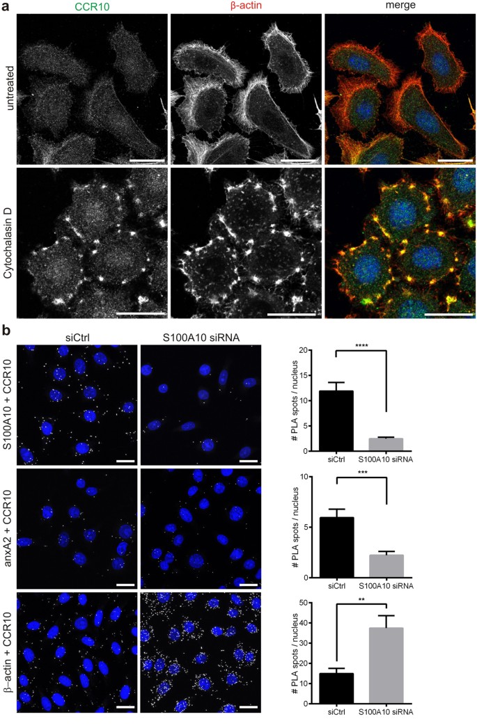 lsm ru nude  CC chemokine receptor 10 cell surface presentation in melanocytes is  regulated by the novel interaction partner S100A10 | Scientific Reports