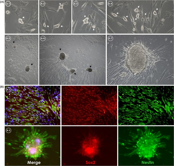 Figure 6: Neural cell differentiation of umbilical cord mesenchymal stromal cells.