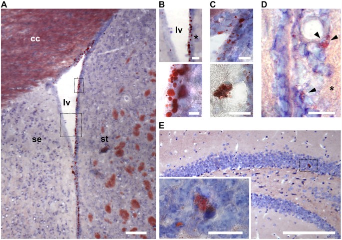 Lipid Laden Cells Differentially Distributed In The Aging Brain Are Functionally Active And Correspond To Distinct Phenotypes Scientific Reports
