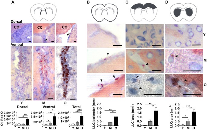 Lipid Laden Cells Differentially Distributed In The Aging Brain Are Functionally Active And Correspond To Distinct Phenotypes Scientific Reports