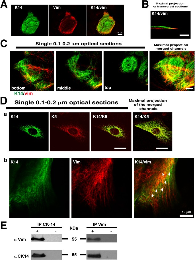 Epithelial cell migration requires the interaction between the vimentin and  keratin intermediate filaments | Scientific Reports