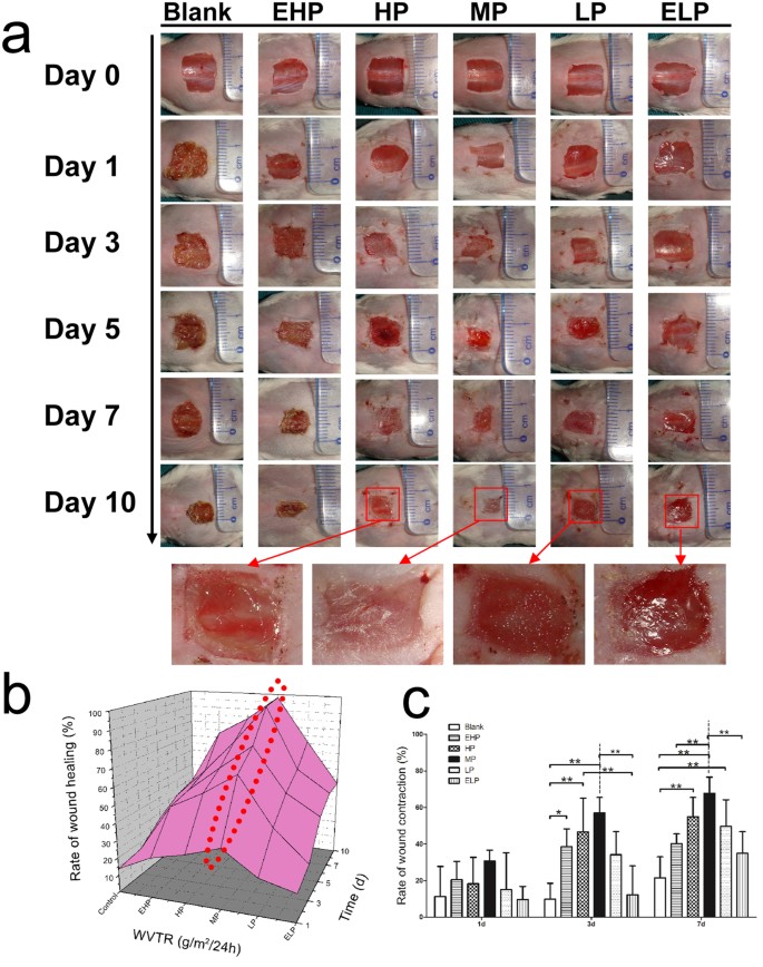 Controlled water vapor transmission rate promotes wound-healing via wound  re-epithelialization and contraction enhancement | Scientific Reports