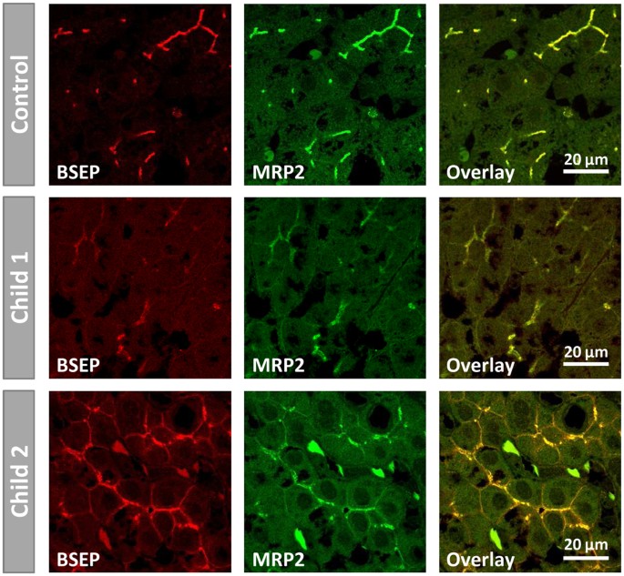 Figure 6: Detection of BSEP and MRP2 in human liver by immunofluorescence.