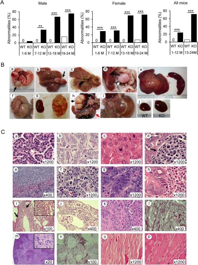 Absence of cytoglobin promotes multiple organ abnormalities in aged mice |  Scientific Reports