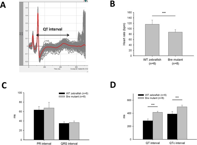 Improvement Of Surface Ecg Recording In Adult Zebrafish Reveals That The Value Of This Model Exceeds Our Expectation Scientific Reports