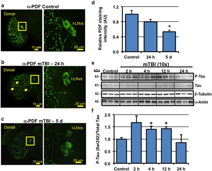 Figure 2: Acute impact of mild TBI on neurons.