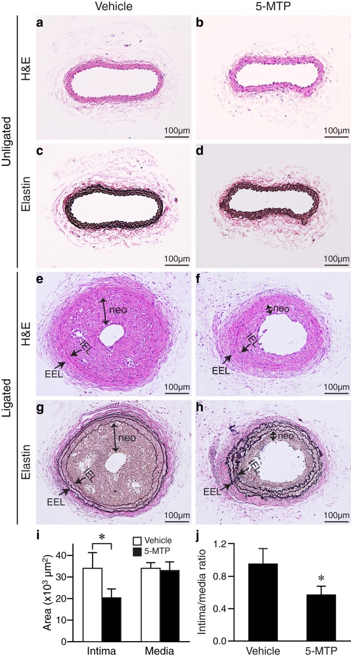 søvn Fiasko porter A Novel Protective Function of 5-Methoxytryptophan in Vascular Injury |  Scientific Reports