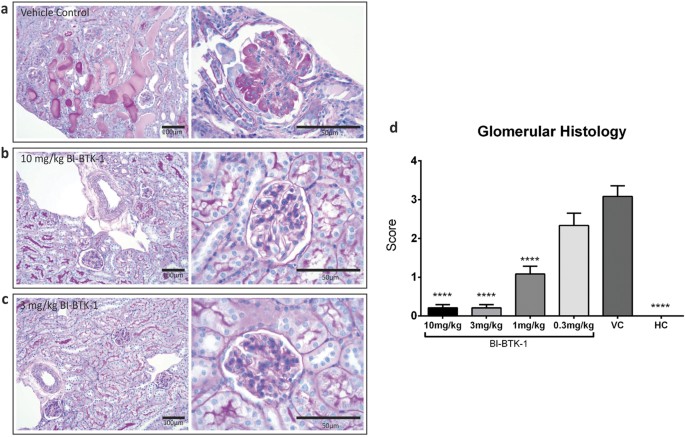 Figure 4: Renal histopathology.