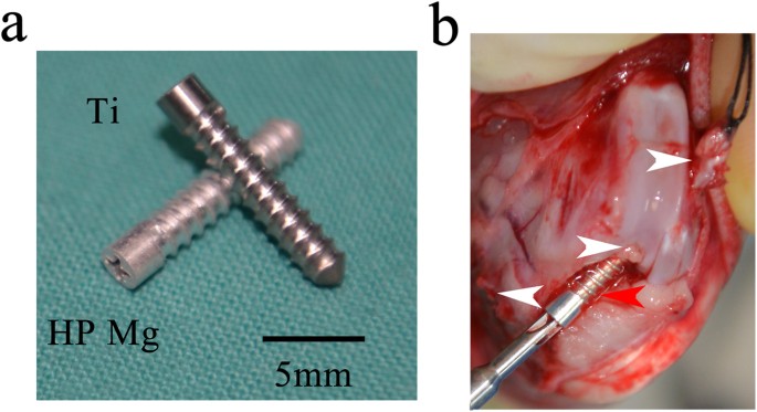 Magnesium Inference Screw Supports Early Graft Incorporation With Inhibition Of Graft Degradation In Anterior Cruciate Ligament Reconstruction Scientific Reports