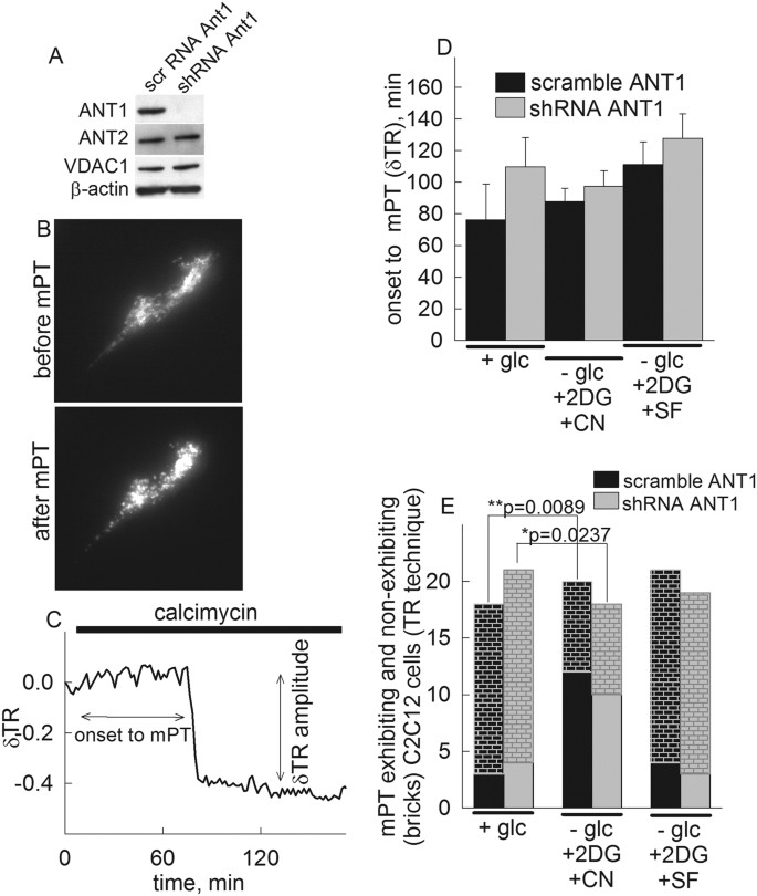 Alterations in voltage-sensing of the mitochondrial permeability transition  pore in ANT1-deficient cells | Scientific Reports