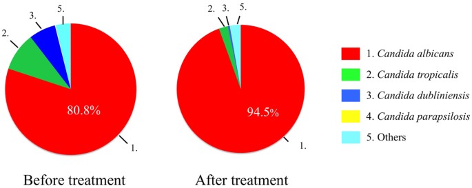 Molecular analysis of fungal populations in patients with oral candidiasis  using next-generation sequencing | Scientific Reports