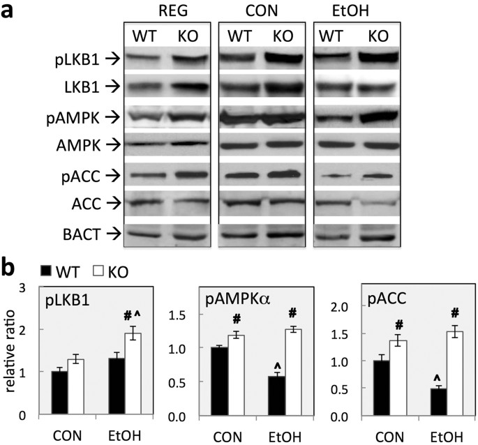 Chronic Glutathione Depletion Confers Protection against Alcohol-induced  Steatosis: Implication for Redox Activation of AMP-activated Protein Kinase  Pathway