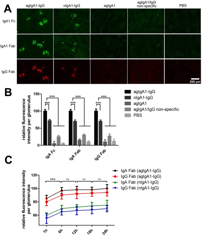 Bacterial IgA protease-mediated degradation of agIgA1 and agIgA1 immune  complexes as a potential therapy for IgA Nephropathy | Scientific Reports