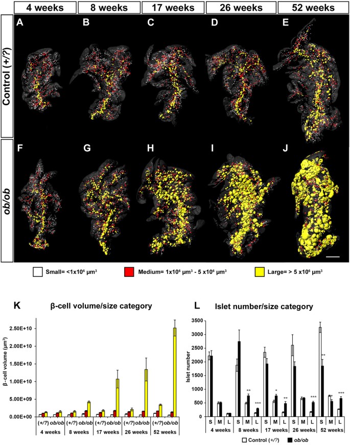 Intra Islet Lesions And Lobular Variations In B Cell Mass Expansion In Ob Ob Mice Revealed By 3d Imaging Of Intact Pancreas Scientific Reports