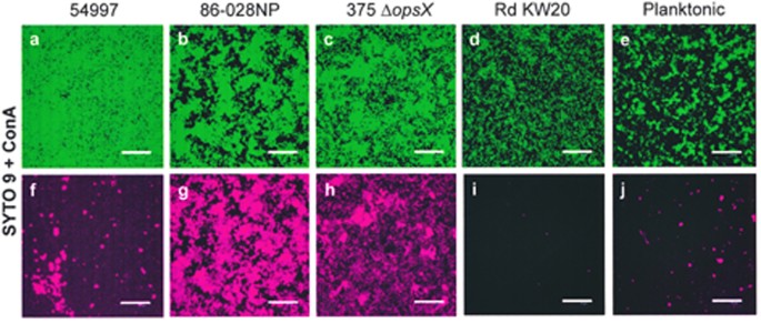 amsb glutathione review Evidence of the presence of nucleic acids and β-glucan in the matrix of non-typeable Haemophilus influenzae in vitro biofilms Considering a Glutathione Supplement? Get