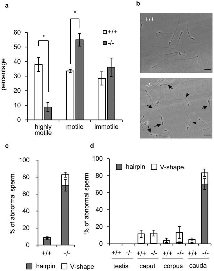 Sperm Motility