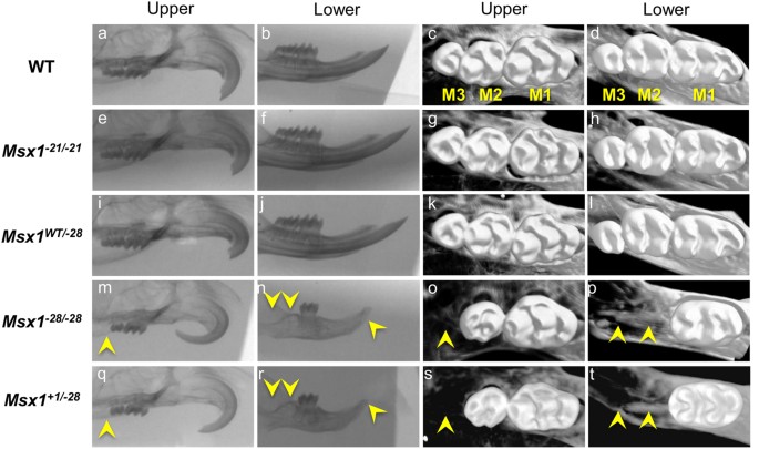 Novel human mutation and CRISPR/Cas genome-edited mice reveal the  importance of C-terminal domain of MSX1 in tooth and palate development |  Scientific Reports