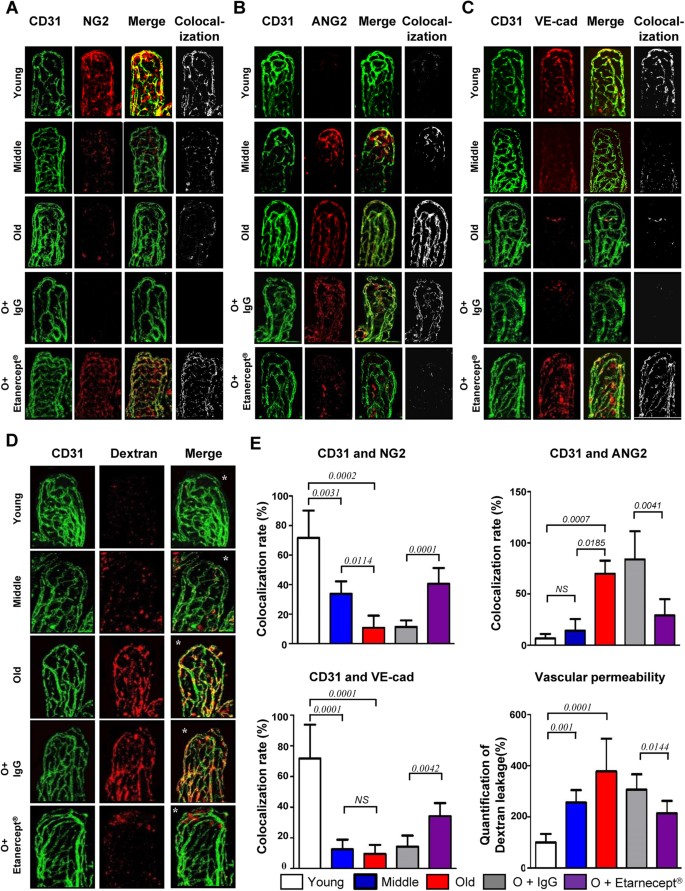 Microvasculature Remodeling In The Mouse Lower Gut During Inflammaging Scientific Reports Microvasculature Remodeling In The Mouse Lower Gut During Inflammaging Scientific Reports