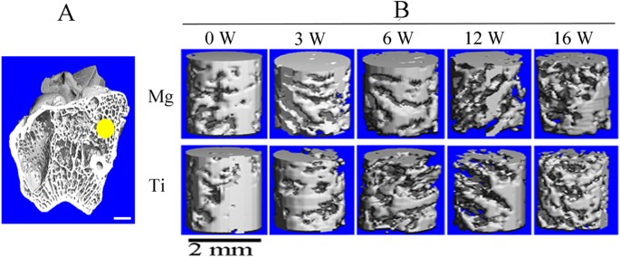 Biodegradable Magnesium Screws Accelerate Fibrous Tissue Mineralization At The Tendon Bone Insertion In Anterior Cruciate Ligament Reconstruction Model Of Rabbit Scientific Reports