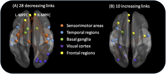 Figure 4: Functional links that exhibited a significant difference in connectivity between the 1st and the 2nd halves of the fMRI time series data.