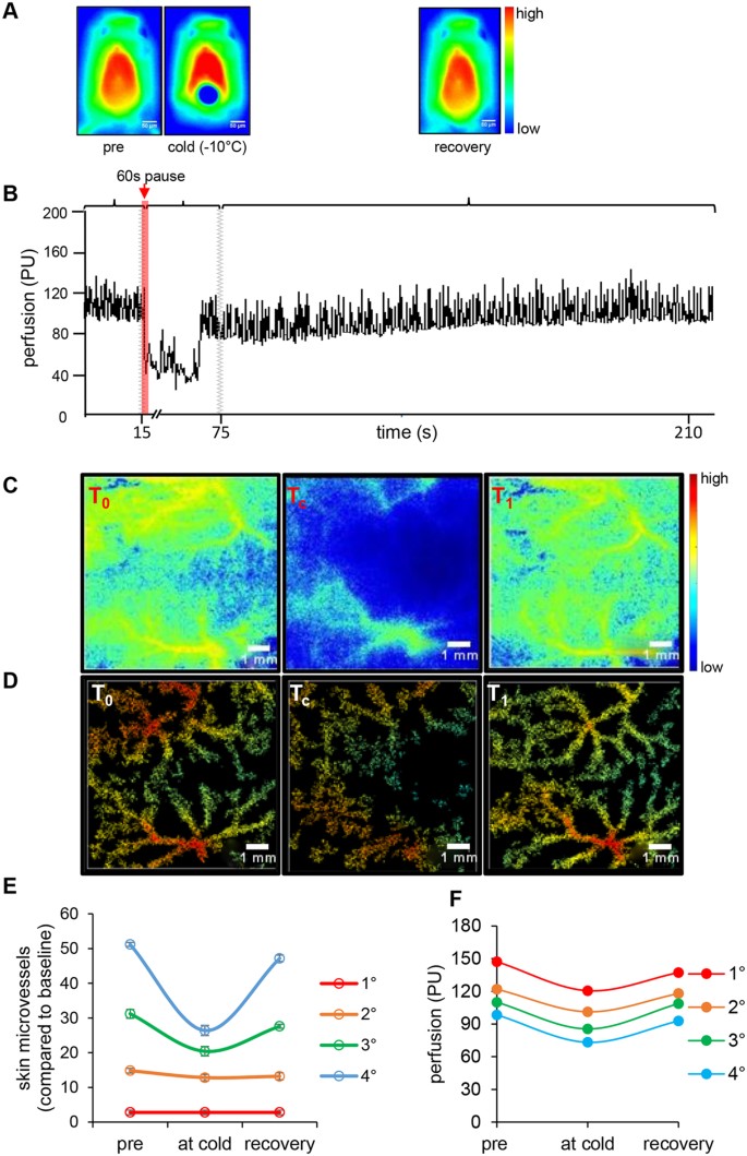 Retooling Laser Speckle Contrast Analysis Algorithm to Enhance Non-Invasive  High Resolution Laser Speckle Functional Imaging of Cutaneous  Microcirculation | Scientific Reports