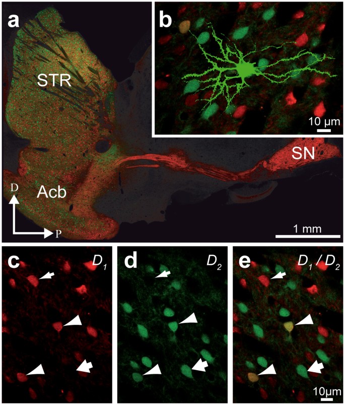 Striatal Neurons Expressing D 1 And D 2 Receptors Are Morphologically Distinct And Differently Affected By Dopamine Denervation In Mice Scientific Reports