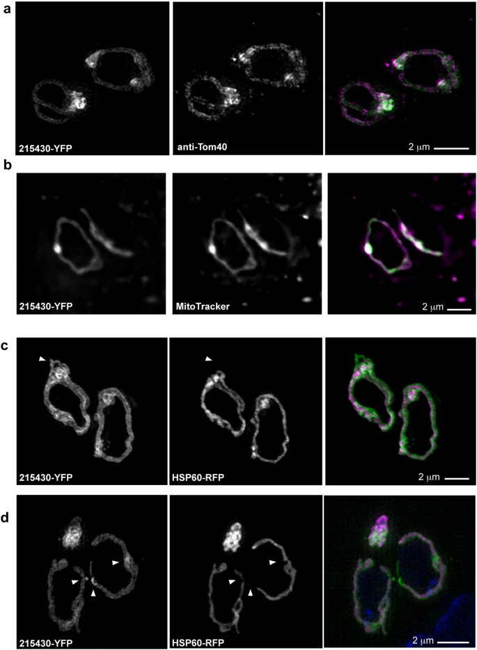 toxoplasma gondi mi ez