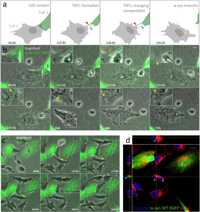 α-synuclein transfer through tunneling nanotubes occurs in SH-SY5Y cells  and primary brain pericytes from Parkinson's disease patients | Scientific  Reports