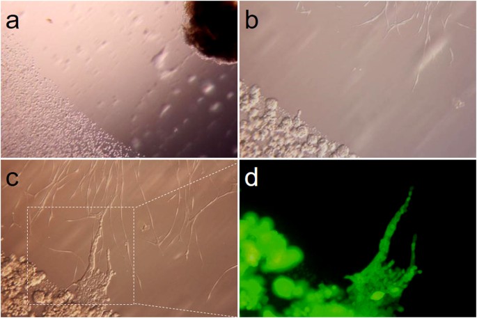 Figure 3: In vitro co-culture model of cancer cell colonies and nerve.