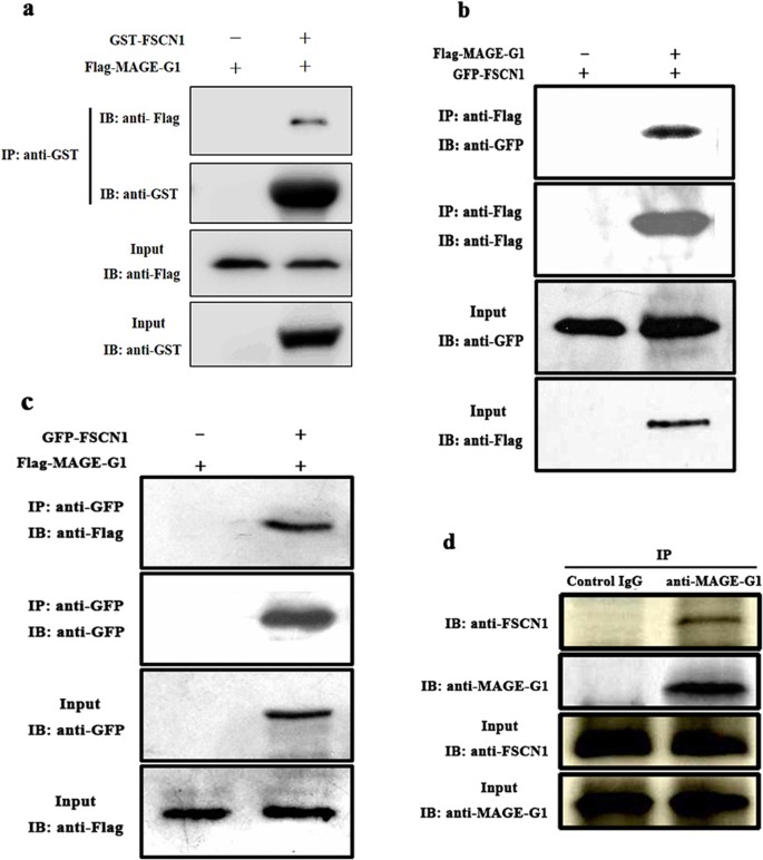 Figure 4: Validation of the interaction between MAGE-G1 and FSCN1 by GST pull-down and co-immunoprecipitation experiments.
