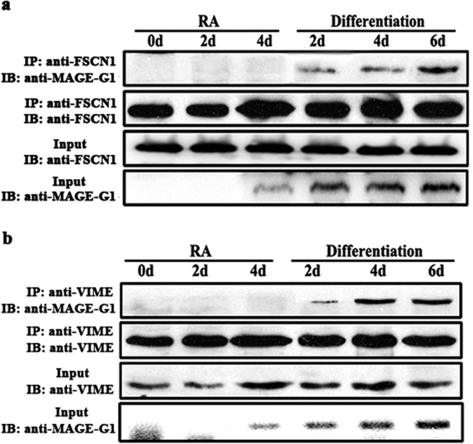 Figure 6: Changes of the interactions between MAGE-G1 and FSCN1 or VIME function in RA-induced P19 neuronal differentiation process.