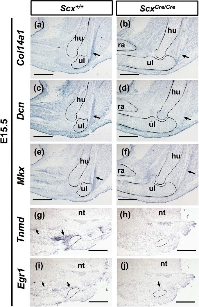 Scleraxis Is Required For Maturation Of Tissue Domains For Proper Integration Of The Musculoskeletal System Scientific Reports