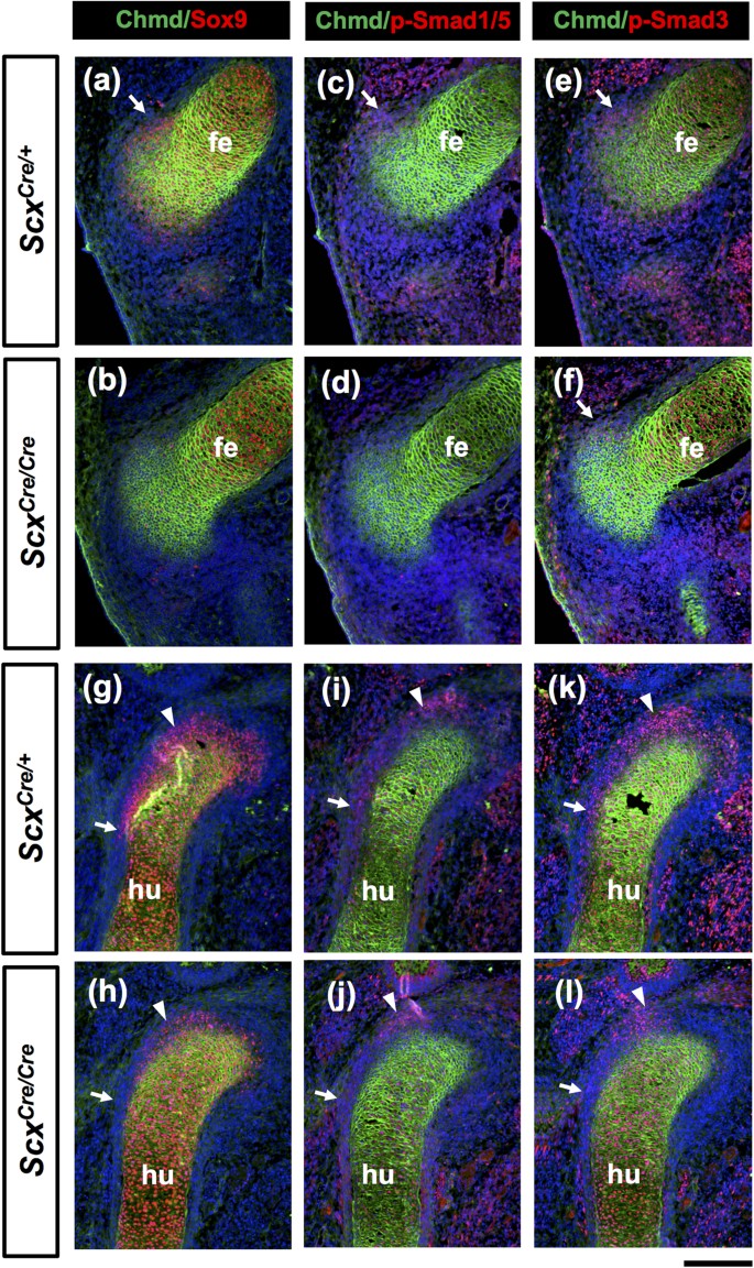 Scleraxis Is Required For Maturation Of Tissue Domains For Proper Integration Of The Musculoskeletal System Scientific Reports