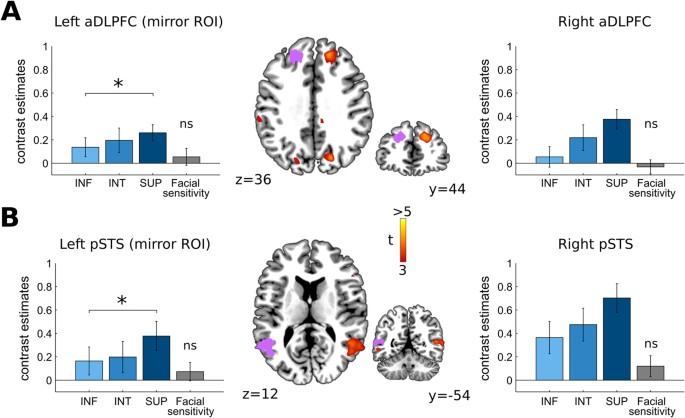 Social brains and divides: the interplay between social dominance  orientation and the neural sensitivity to hierarchical ranks | Scientific  Reports