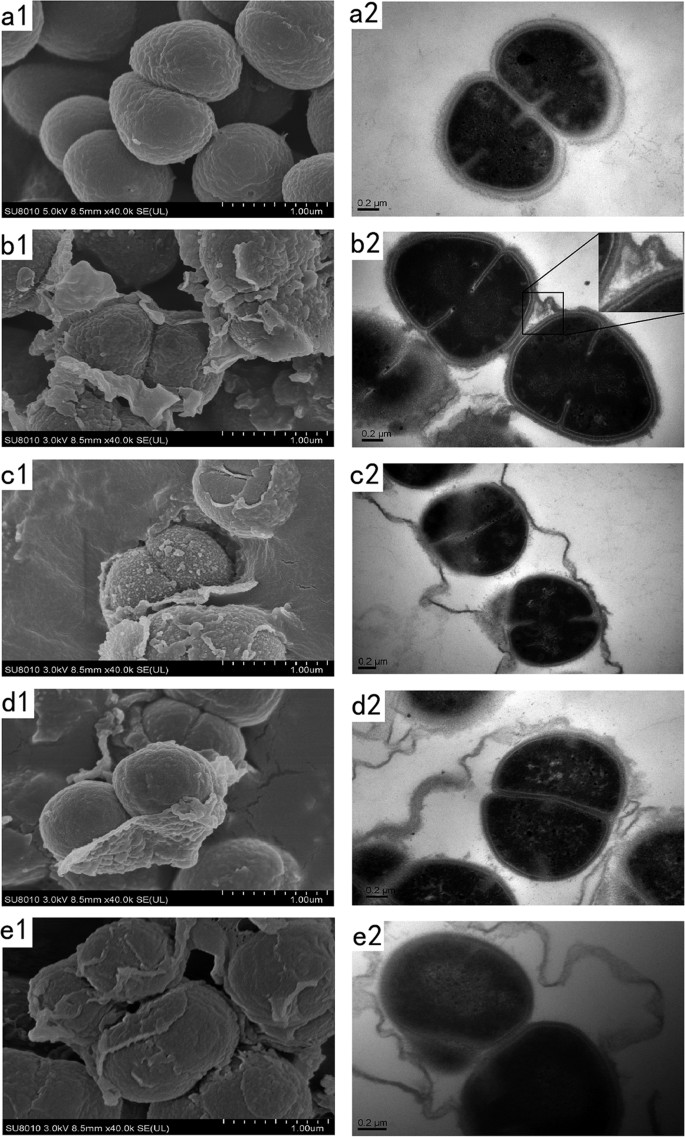 The interplay between Mn and Fe in Deinococcus radiodurans