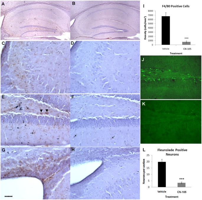 Neuroprotective Pentapeptide Cn 105 Is Associated With Reduced Sterile Inflammation And Improved Functional Outcomes In A Traumatic Brain Injury Murine Model Scientific Reports