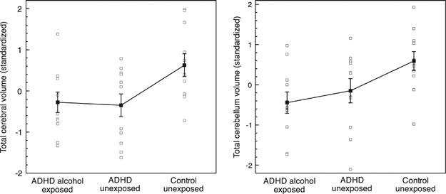 prenatal alcohol exposure x adhd prenatal alcohol exposure x adhd