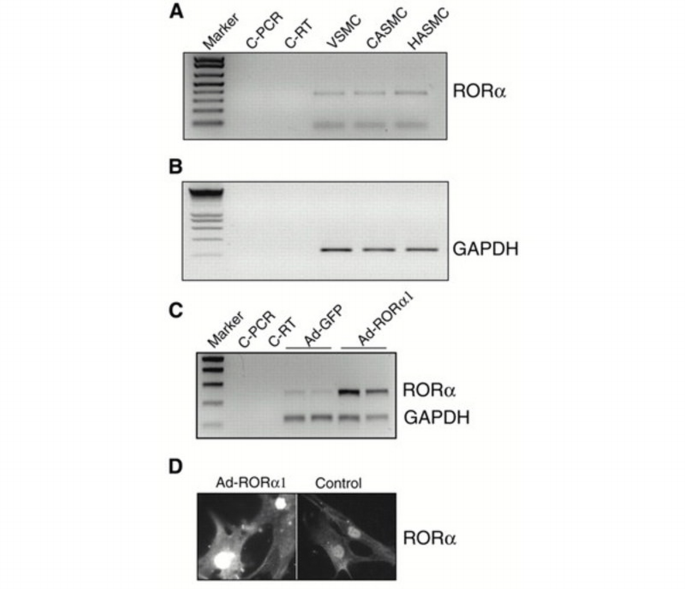Msrf Ror The orphan nuclear receptor RORα is a negative regulator of the ...