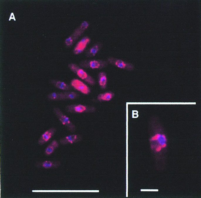 Localization of the 26S proteasome during mitosis and meiosis in ...
