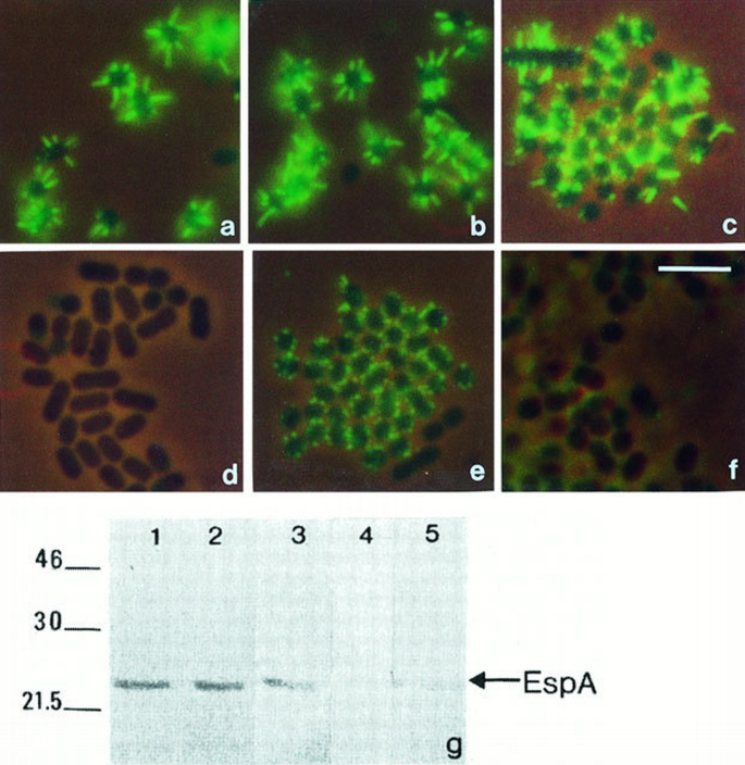 A novel EspA‐associated surface organelle of enteropathogenic ...