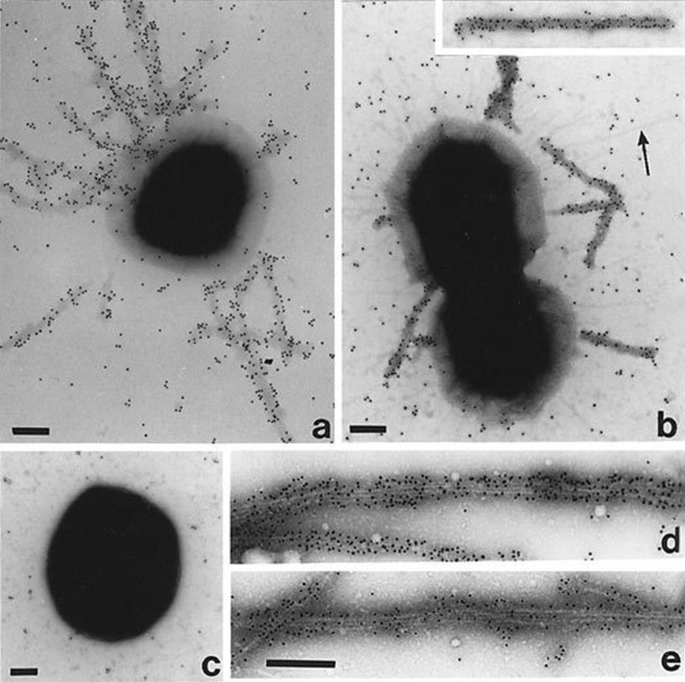 A novel EspA‐associated surface organelle of enteropathogenic ...