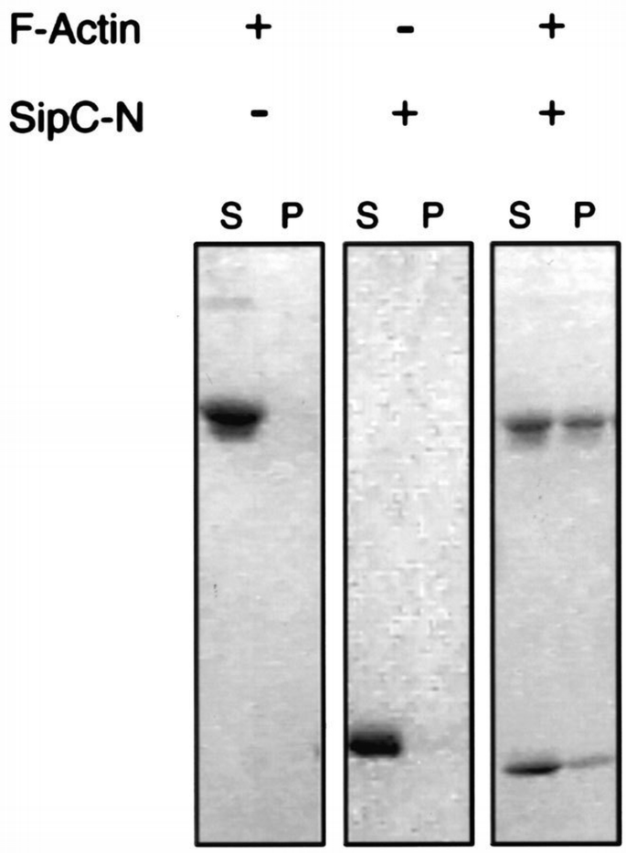 Direct nucleation and bundling of actin by the SipC protein of invasive ...