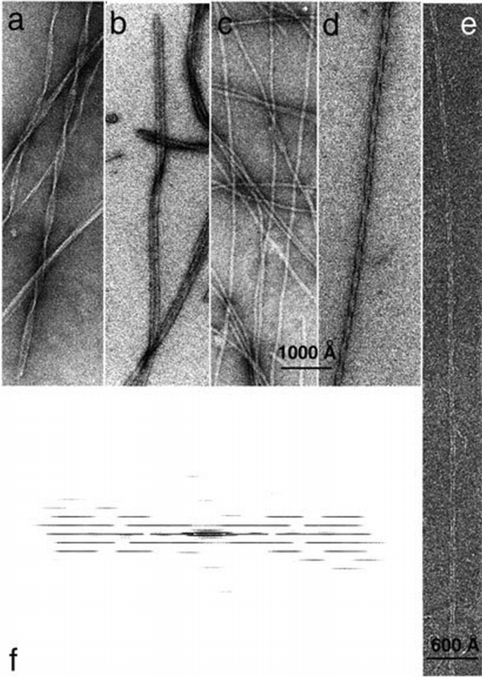 Cryo‐electron microscopy structure of an SH3 amyloid fibril and model ...