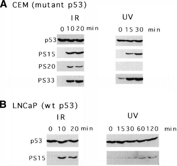 DNA damage‐inducible phosphorylation of p53 at N‐terminal sites ...