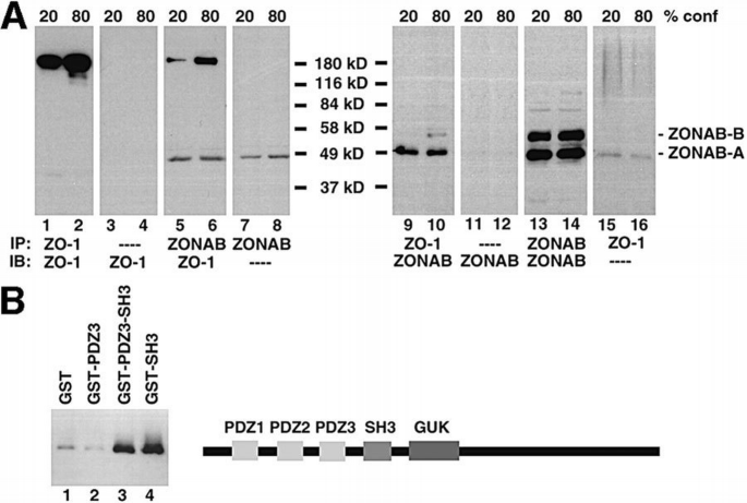 The tight junction protein ZO‐1 and an interacting transcription factor ...