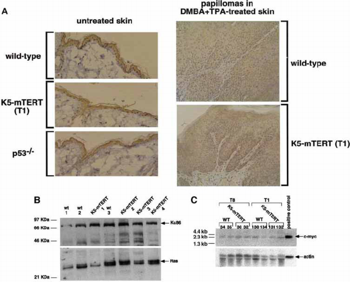 Increased epidermal tumors and increased skin wound healing in ...