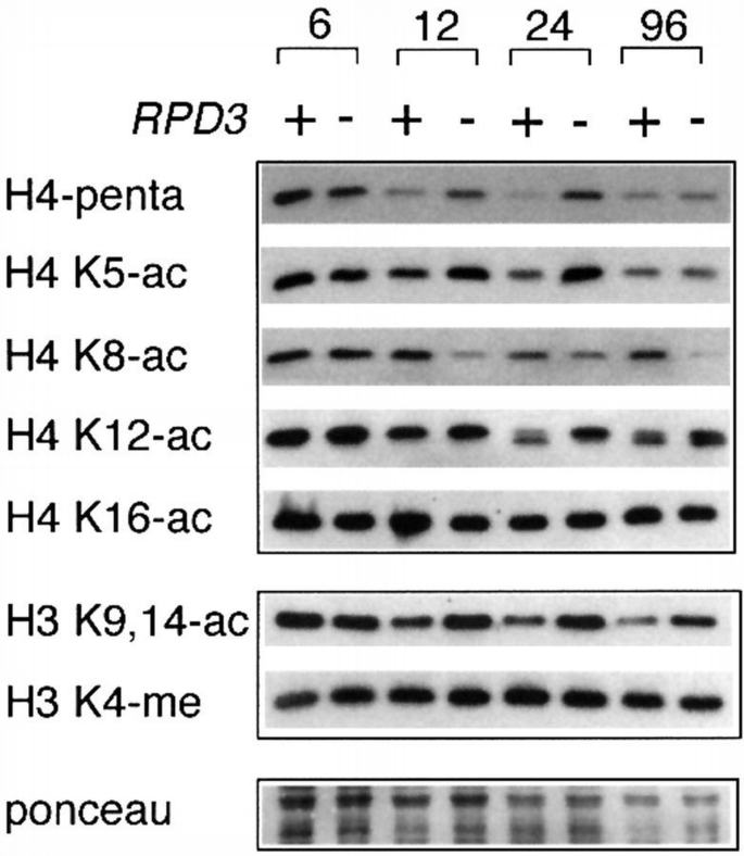 RPD3 is required for the inactivation of yeast ribosomal DNA genes in ...