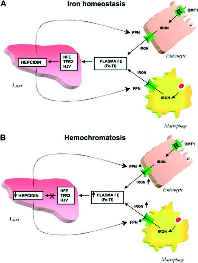 HFE-associated hereditary hemochromatosis | Genetics in Medicine