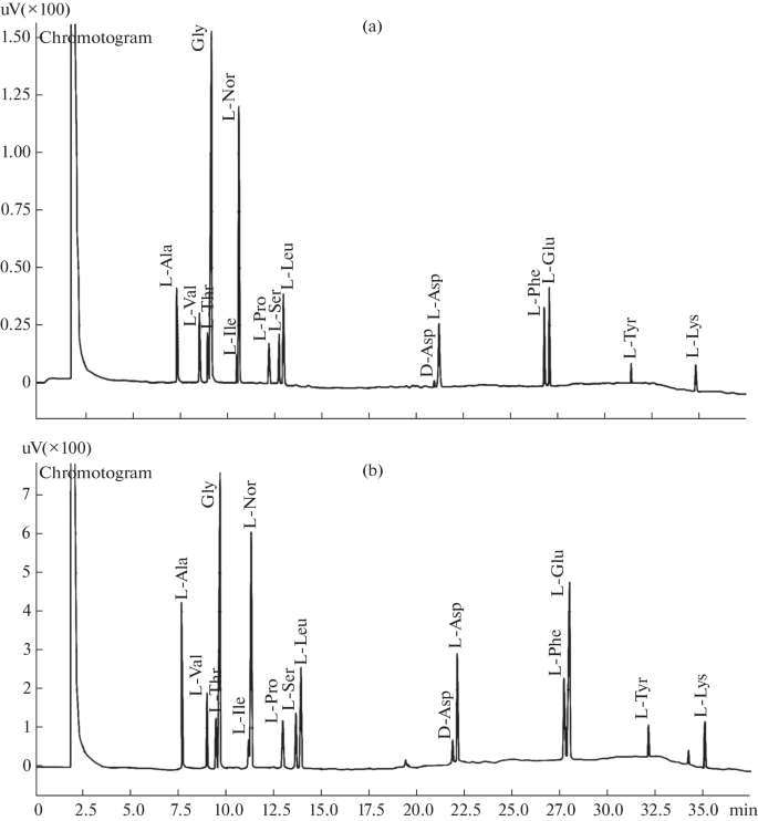 Chromatographic Analysis of the Amino Acid Composition of Gallstones